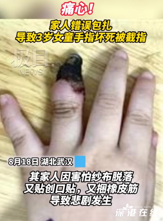 家人错误包扎致3岁女童手指坏死,毕竟是怎么回事呢？